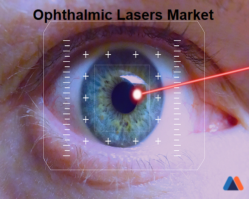 Ophthalmic Lasers Market.jpg